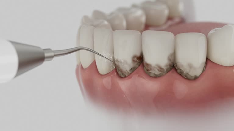 Trusted Wisdom Tooth Removal service in Fulton, IL - Dentist Open Now